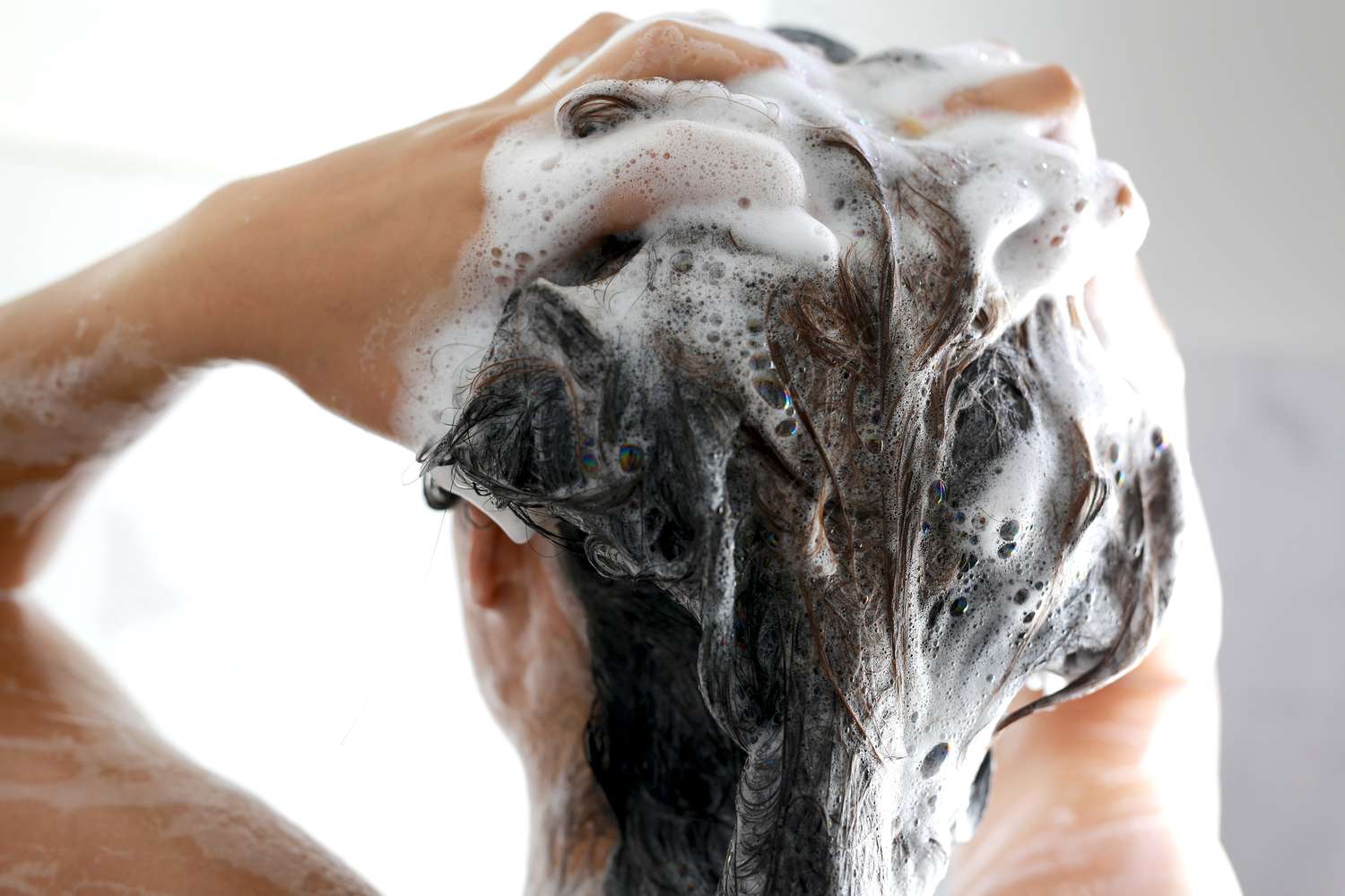 Dry Scalp Defense: Your Guide to Moisture and Comfort