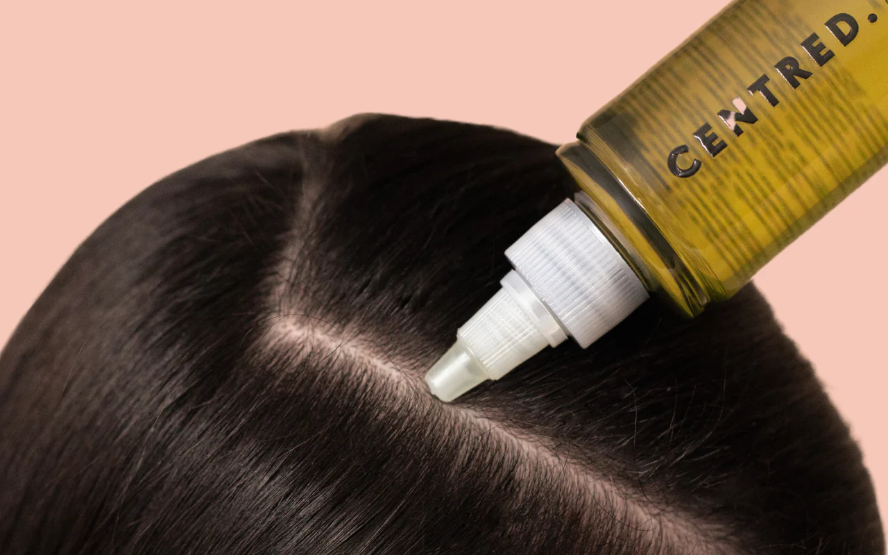 Scalp SOS: Rescue Plans for Common Scalp Issues